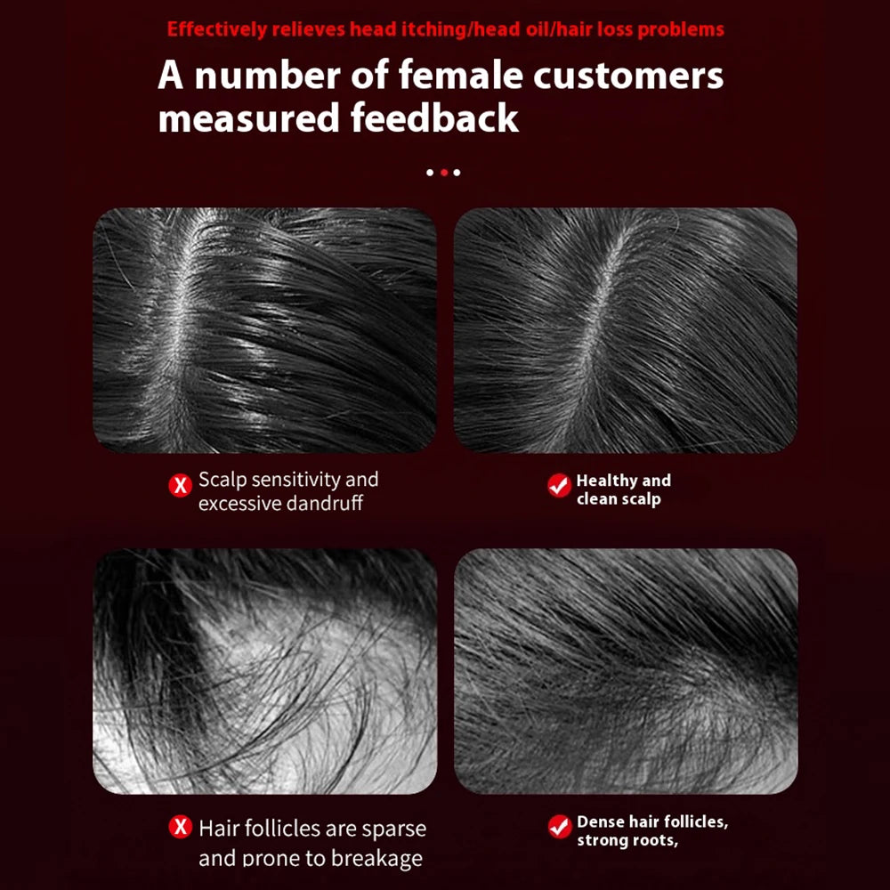 Scalpify Red light Massager