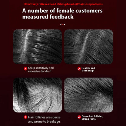 Scalpify Red light Massager