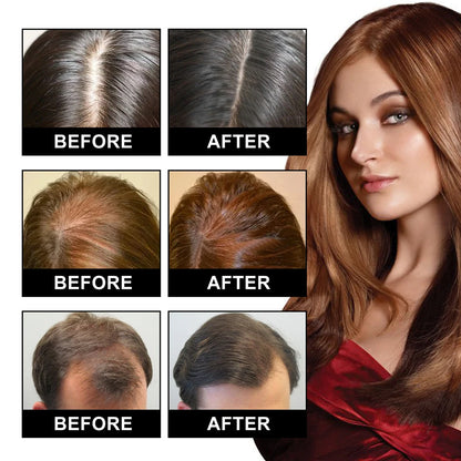 Scalpify Red light Massager